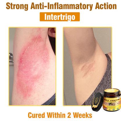 Bee Venom All-in-One Cream US Dermatologist Approved🐝