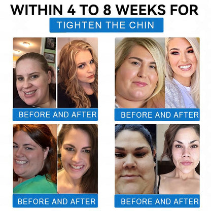 【Last Day Promotion 80% OFF🌟】🎃🎃Peachlife®  𝐓𝐢𝐫𝐳𝐞𝐩𝐚𝐭𝐢𝐝𝐞 & 𝐂𝐨𝐥𝐥𝐚𝐠𝐞𝐧 𝐍𝐚𝐧𝐨 𝐌𝐢𝐜𝐫𝐨𝐧𝐞𝐞𝐝𝐥𝐞 𝐖𝐞𝐢𝐠𝐡𝐭 𝐋𝐨𝐬𝐬 𝐏𝐚𝐭𝐜𝐡丨Targets Obesity, Loose Skin,  Joint Pain, Brain Fog, Low Energy, Body Aches, and More