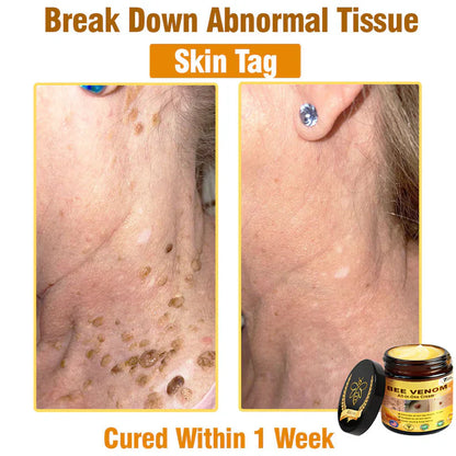Bee Venom All-in-One Cream US Dermatologist Approved🐝